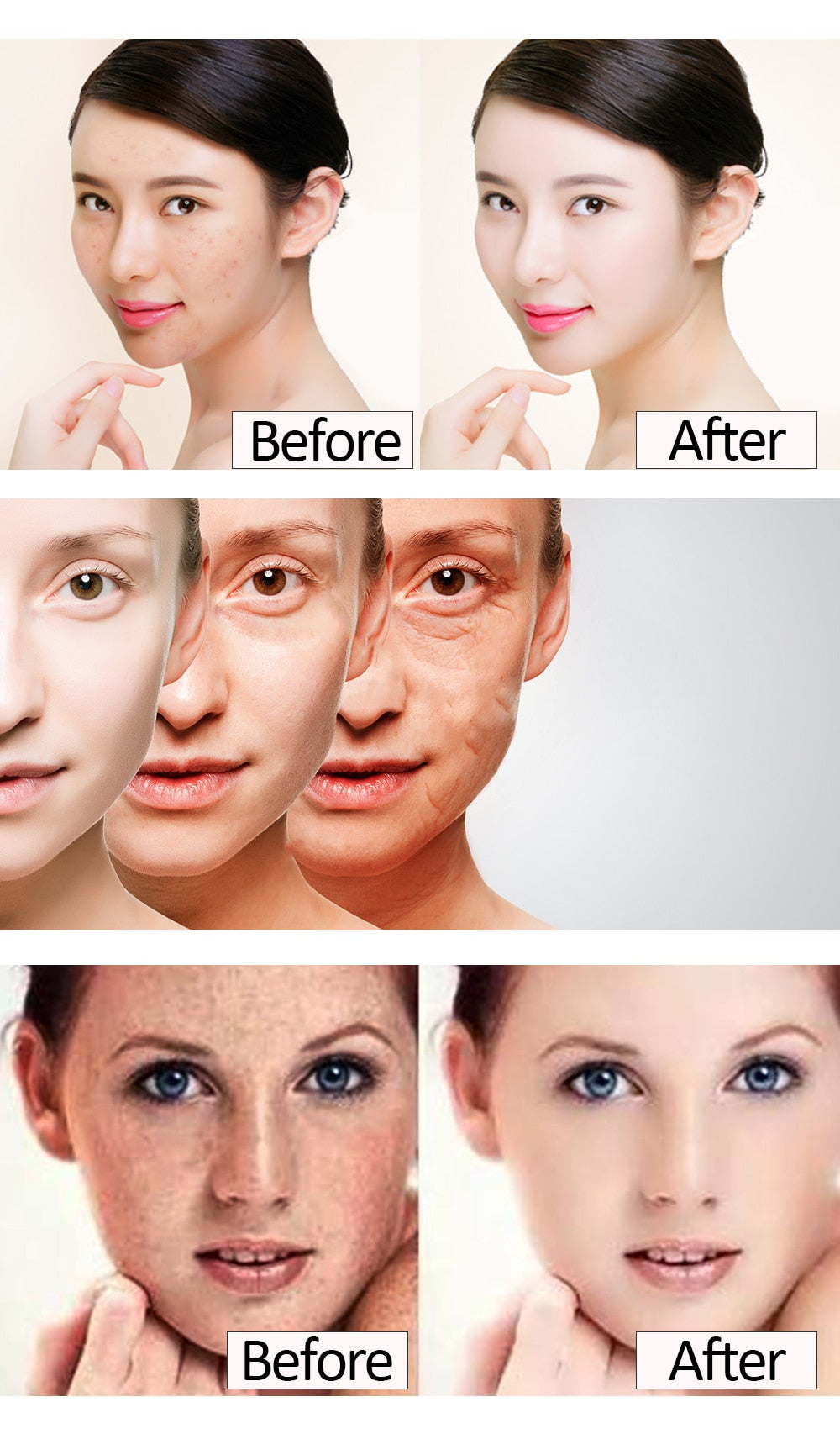 EMS Mesotherapy Electroporation Skin Care Tighten Lifting Facial